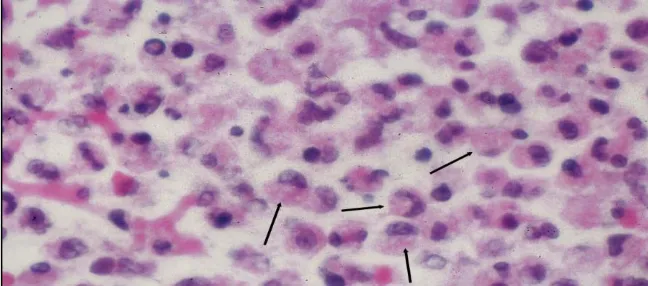 Gambar 4. Sel Makrofag (panah hitam), memiliki bentuk seperti ginjal,             sering berada di satu sisi dari sel.28 