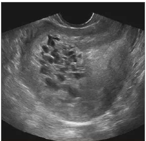 Gambar  2.5 Pemeriksaan Ultrasonografi MHK 