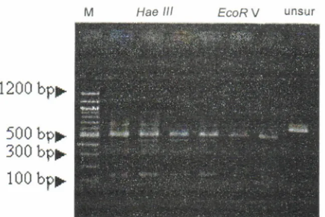Figure  3.  Template DNA  digested  with  EcoR  V  and  Hae  lll  restriction  enzym  of  pond  reared black  tiger