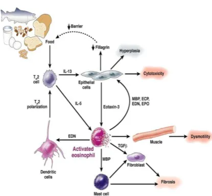 Tabel 1. Karakteristik eosinofilik esofagitis7 