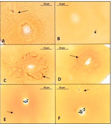 Figure 5. Molecular identification of PCN in East Java: molecular weight marker, 100 bp (M); line: Batu (1); Probolinggo (2);Magetan (3); Pasuruan (4); all were identified as Globodera rostochiensis