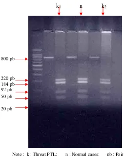 Figure 6.   DNA fragment of Elastase Gene after cut by HpaII Enzyme from the 