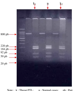 Figure 6.   DNA fragment of Elastase Gene after cut by HpaII Enzyme from the 