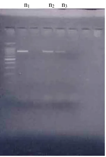 Figure 2 PCR amplification result of Elastase gene in Threatened Preterm Labor 