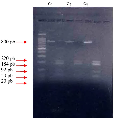 Figure 3 PCR amplification result of Elastase Gene in normal pregnancy 