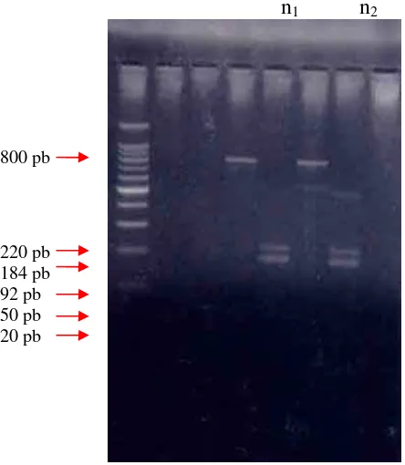 Figure 4.  Fragmen DNA fragment of Elastase Gene after cut by HpaII enzyme 