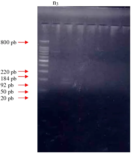 Figure 5.    DNA fragment of Elastase Gene after cut by HpaII enzyme in Normal Pregnancy  