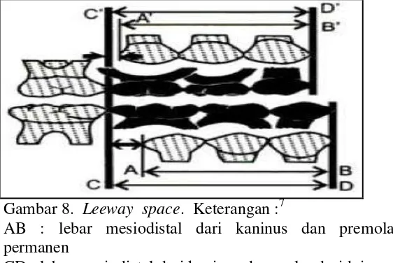 Gambar 8.  Leeway  space.  Keterangan :7 