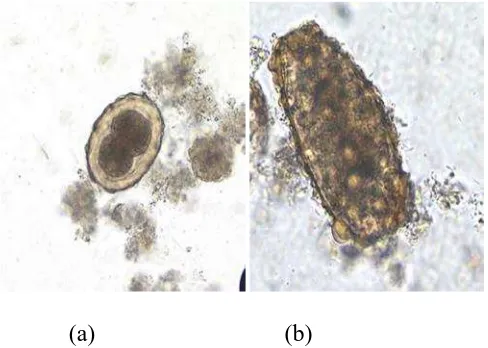 Gambar 2. Telur cacing Ascaris lumbricoides (a) fertilized egg (b)Unfertilized egg (CDC, 2013).