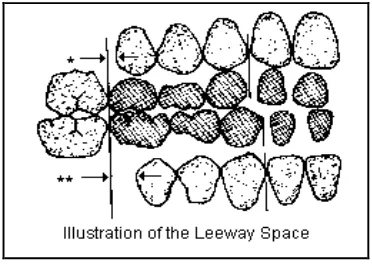 Gambar 9. Leeway space26 