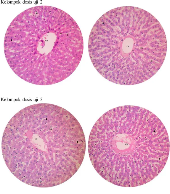 Gambar  1. Histopatologi  hepar 