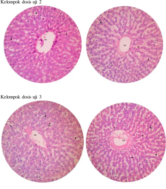 Gambar  1. Histopatologi  hepar 