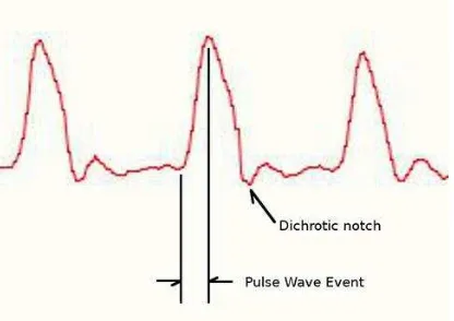 Gambar 2.7 Gelombang Pulse Sensor 