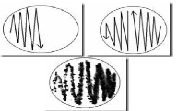 Gambar 2.11. Teknik isolasi bakteri dengan streak plate method.  Sumber: (Jutono dkk., 1980)