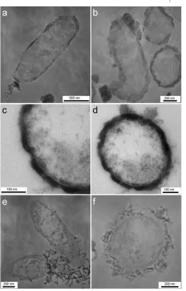 FIG. 5.Scanning transmission electron micrographs of cells of the nitrate-reducing Fe(II)-oxidizing bacterium Acidovorax sp