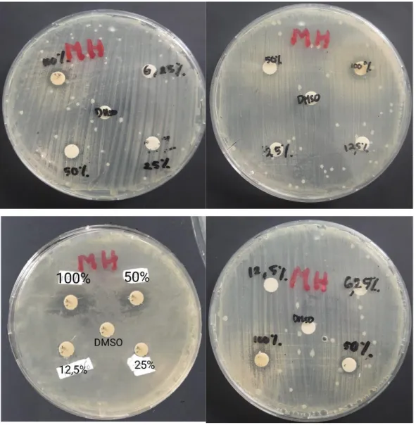 Uji Aktivitas Antimikroba - HASIL PENELITIAN DAN PEMBAHASAN 4.1 ...