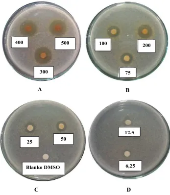 Gambar hasil uji aktivitas antibakteri fraksi etilasetat kulit buah markisa ungu  terhadap bakteri Escherichia coli 