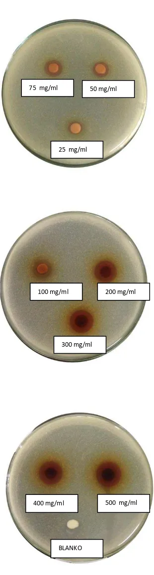 Gambar hasil uji aktivitas antibakteri terhadap bakteri epidermidis 
