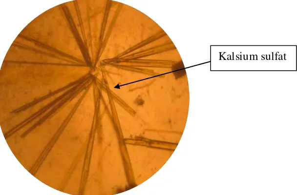 Gambar 2. Kristal Kalium Pikrat (Perbesaran 10 x 40) 