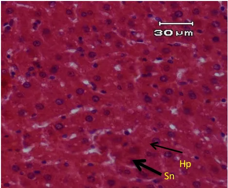 Gambar 1. Gambaran mikroanatomi sel hati 
