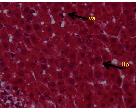 Gambar 4. Gambaran mikroanatomi sel hati kelompok KD2 