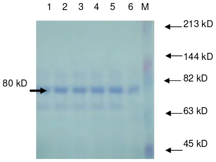 Gambar 2. Hasil elektroforesis laktoferin standar   