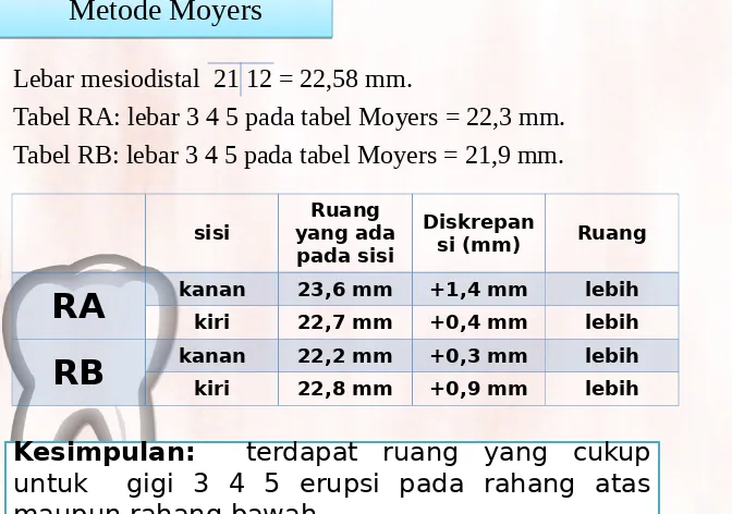 Tabel RA: lebar 3 4 5 pada tabel Moyers = 22,3 mm.