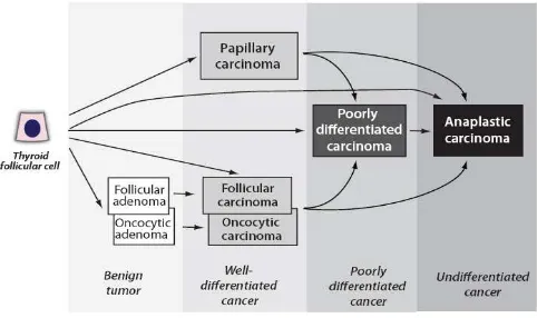 Gambar 2.1. Skema progresifitas dan diferensiasi tumor tiroid dari sel folikel 31