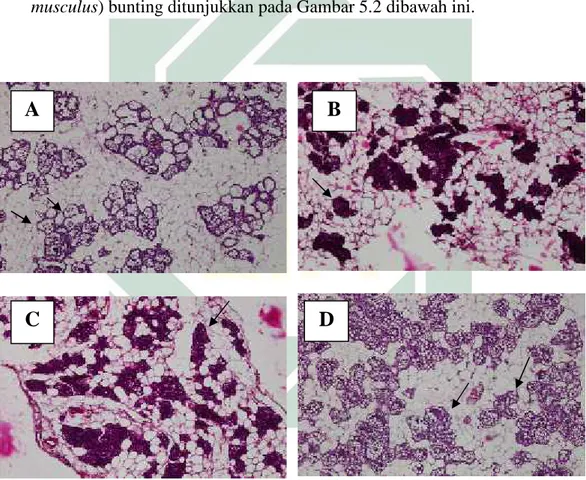 Gambar  5.2 Gambaran  histologi  kelenjar  mammae  (Perbesaran  10x10)  pada  sel-sel  asinus
