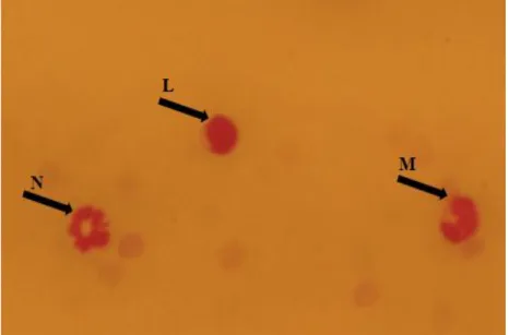 Gambar  1.  Morfologi  jenis-jenis  leukosit  yang diamati  di  bawah  mikroskop pada pembesaran 10 x 40.