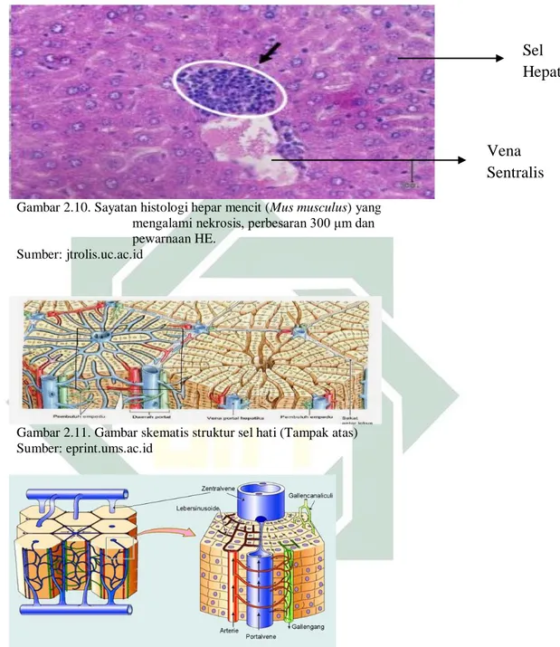 Gambar 2.10. Sayatan histologi hepar mencit (Mus musculus) yang  mengalami nekrosis, perbesaran 300 μm dan  pewarnaan HE