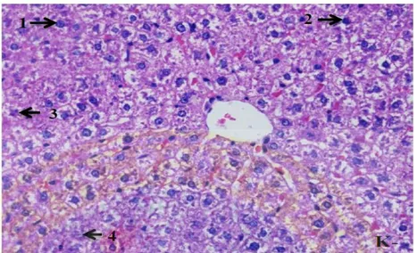 Gambar 3.1. Histopatologi nekrosis sel hepar tikus (Rattus novergicus). (1) sel  hepar normal (2) sel hepar yang mengalami nekrosis berupa piknotik (3) sel  hepar yang mengalami nekrosis berupa kariokinesis (4) sel hepar yang  mengalami nekrosis berupa kar