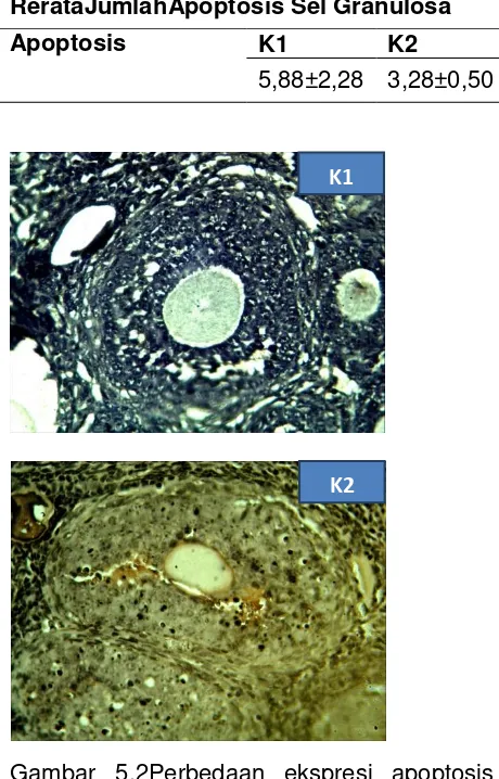 Gambar 5.2Perbedaan ekspresi apoptosis antar kelompok perlakuan. Ekspresi apoptosis tampak sel imunoreaktif yang diekspresikan bewarna cokelat