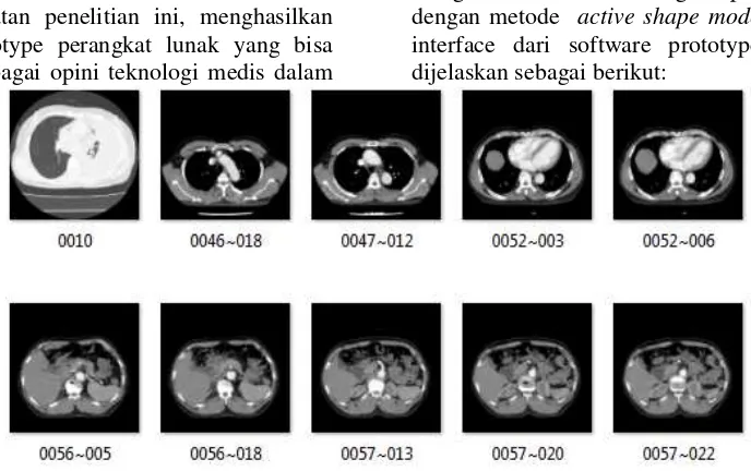Gambar 2. Citra paru yang di ambil dari Rumah Sakit  (Lab. Radiologi RSUD Sukoharjo, 2016) 