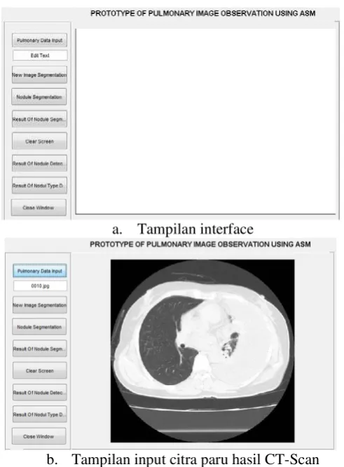 Gambar 3. Desain interface prototype observasi paru (hasil penelitian HB 2016) 