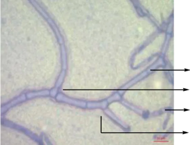 Gambar 4.8. Mikroskopis Jamur Rhizoctonia solani  (Sumber: Foto Langsung) 