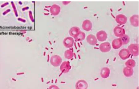 Gambar 6.Pewarnaan Gram Acinetobacter baumannii
