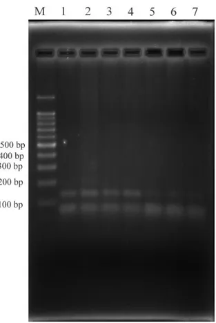 Gambar 2: Elektrofotogram pemeriksaan virus dengue dengan RT PCR pada nyamuk           Ae.aegypti dari lokasi Perumahan Unand Gadut