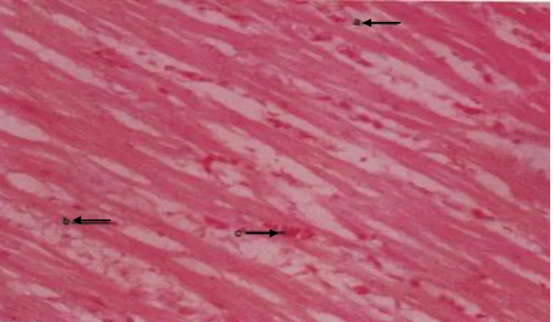 Gambar 1. Mikrograf jantung pada kelompok diberi ransum standar 521 mengandung 3% minyak sawit normal (P1)
