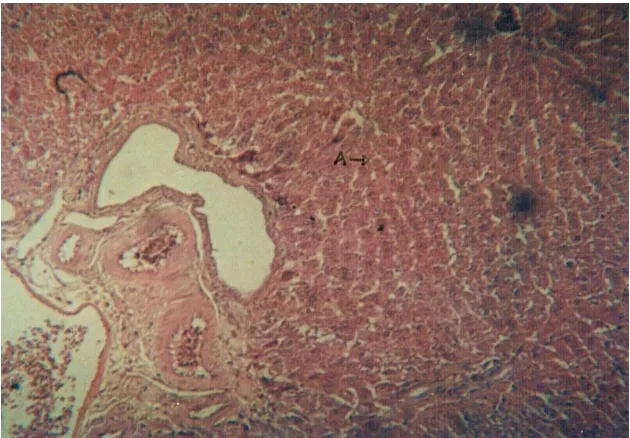 Gambar 2. Degenerasi hepatosit 