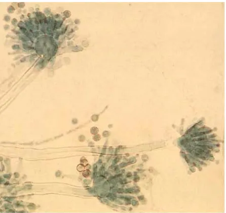 Gambar 2.1 Gambaran mikroskopis Aspergillus fumigatus. (Tomas et al, 2001) 