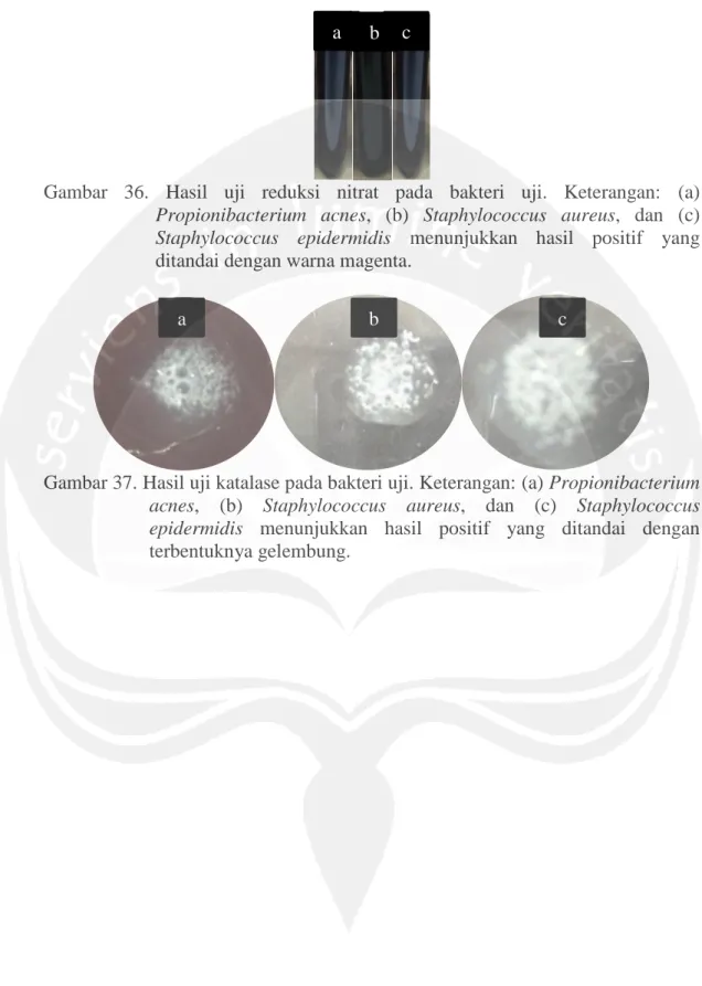 Gambar  36.  Hasil  uji  reduksi  nitrat  pada  bakteri  uji.  Keterangan:  (a)  Propionibacterium  acnes,  (b)  Staphylococcus  aureus,  dan  (c)  Staphylococcus  epidermidis  menunjukkan  hasil  positif  yang  ditandai dengan warna magenta