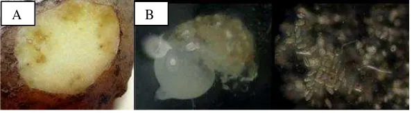 Gambar 2: A.Gejala serangan nematoda puru akarpada  umbi kentang             B. Massa telur Meloidogyne spp.Pada jaringan umbi kentang (Sumber : Aprilyani et al., 2015)     