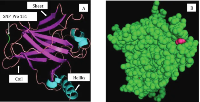 Gambar 8. Struktur 3D mutan TP53 Pro151Ser. Warna hijau pada gambar (A) menunjukkan posisi mutasi SNP 