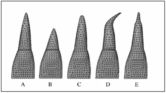 Gambar 12. Klasifikasi bentuk akar oleh Lavender dan Malmgren  (1988) A) Normal B) Pendek C) Tumpul D) Bengkok E) Bentuk pipet15 