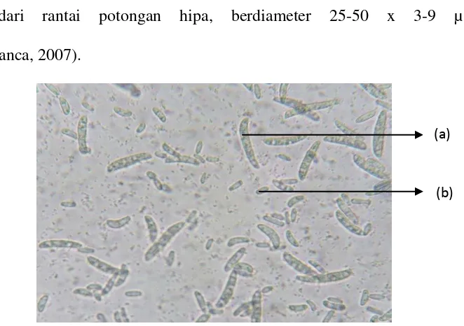 Gambar 1. Mikroskopis patogen F. moniliforme dengan perbesaran 400x; (a) Makrokonidia (b) Mikrokinidia (Putri, 2014) 