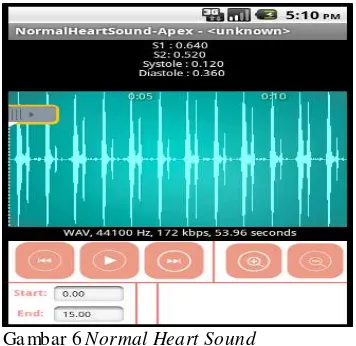 Gambar 6 Normal Heart Sound  
