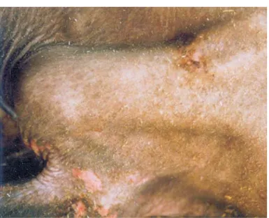 Fig. 3. Rough hair coat and decubital skin lesions in affected buffalo