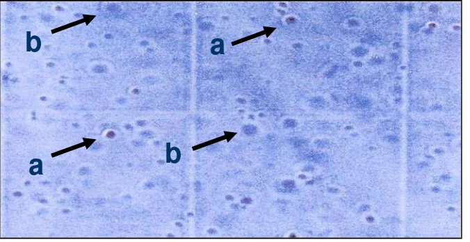 Gambar 2. Perbandingan sel kanker hidup dan mati (a) sel hidup dan (b) sel mati.