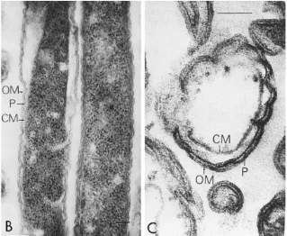 Gambar 2. F.nucleatum dibawah mikroskop elektron   Outer membrane (OM), Perisplasmic space (P), dan Cell membrane(CM)14 